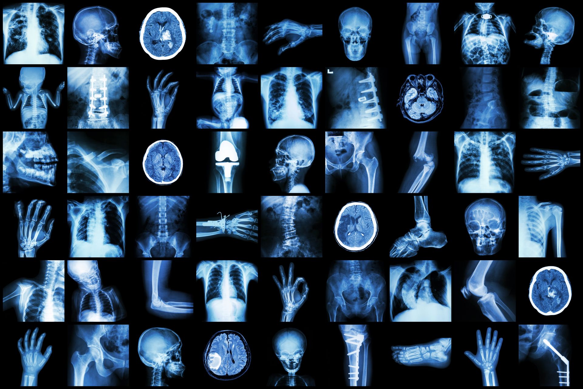 Radiologische Befunde Verstehen Arthrose Journal