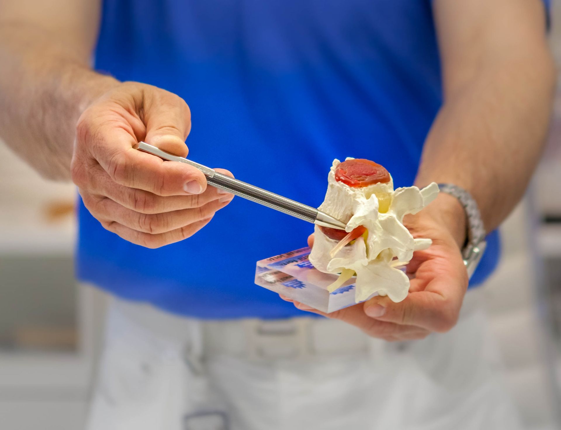 Wirbelsäulengelenkarthrose – wie behandeln? - Arthrose Journal